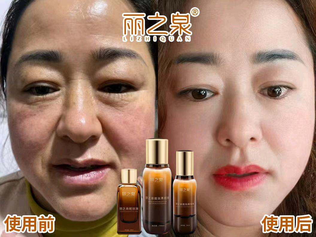 毛先生SOD生物调肤抗衰*