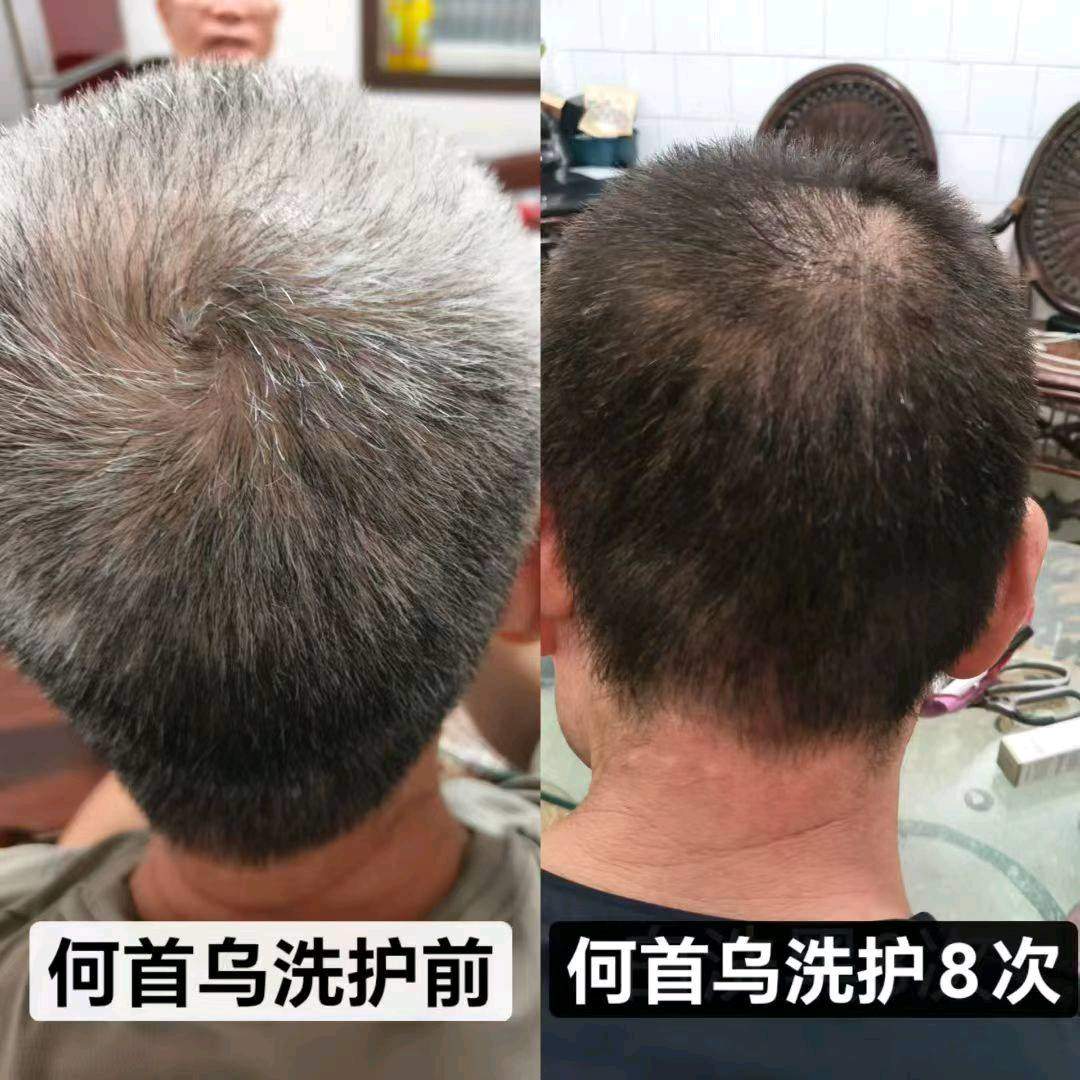 赖先生品牌货源何首乌白洗黑洗护套装 源头供应