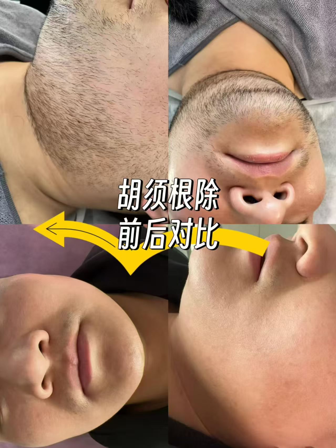 孙鹏找合伙人男士胡须管理美容项目，零竞争，小白三天落地，*