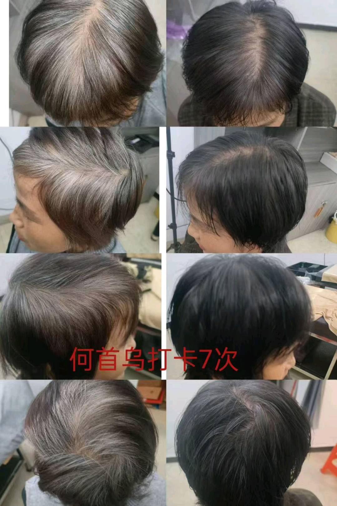 赖先生找合伙人白洗黑洗发水供应