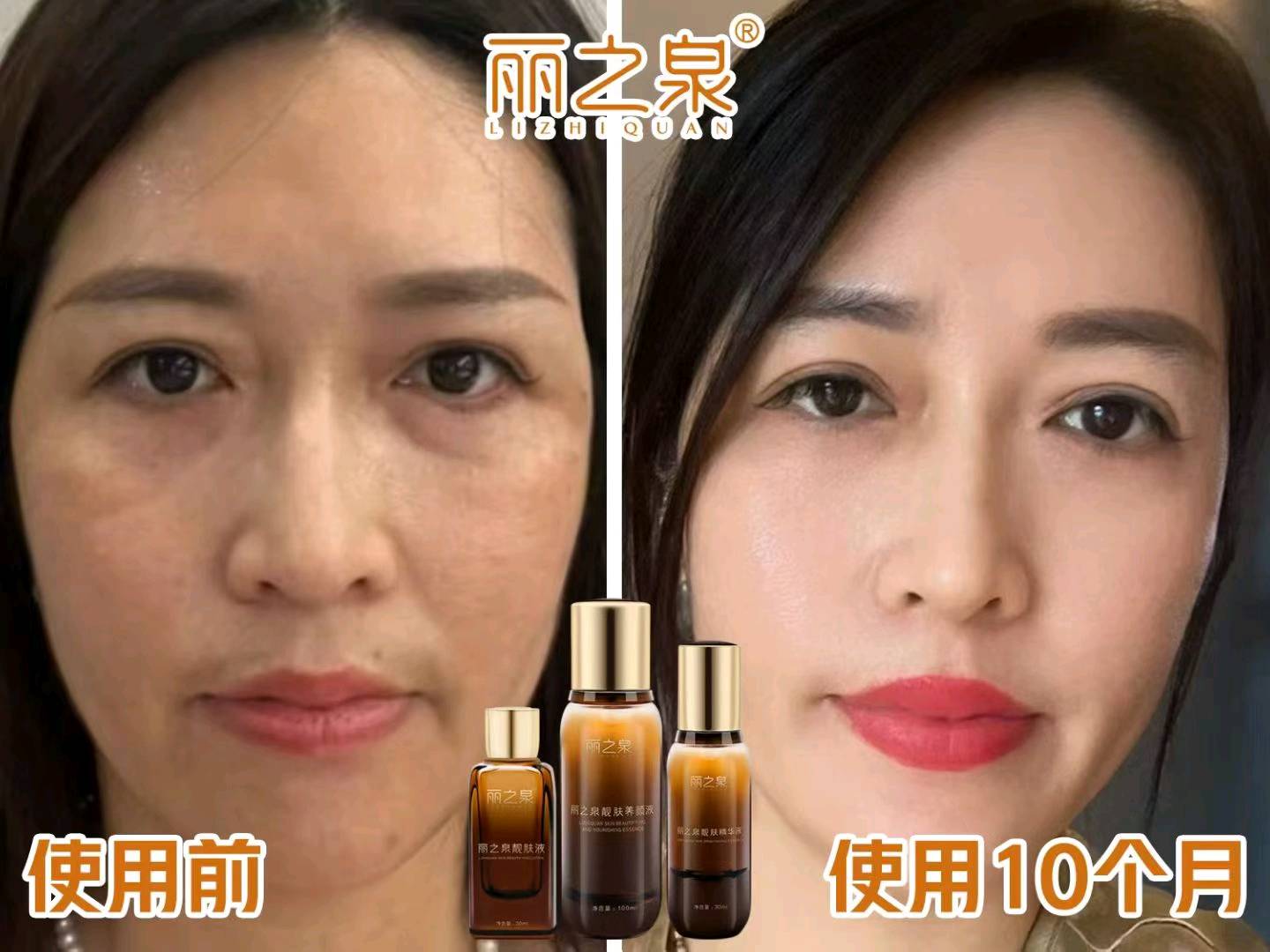 毛先生其他供需调肤抗衰赛道，女人爱美的生意调肤抗衰赛道