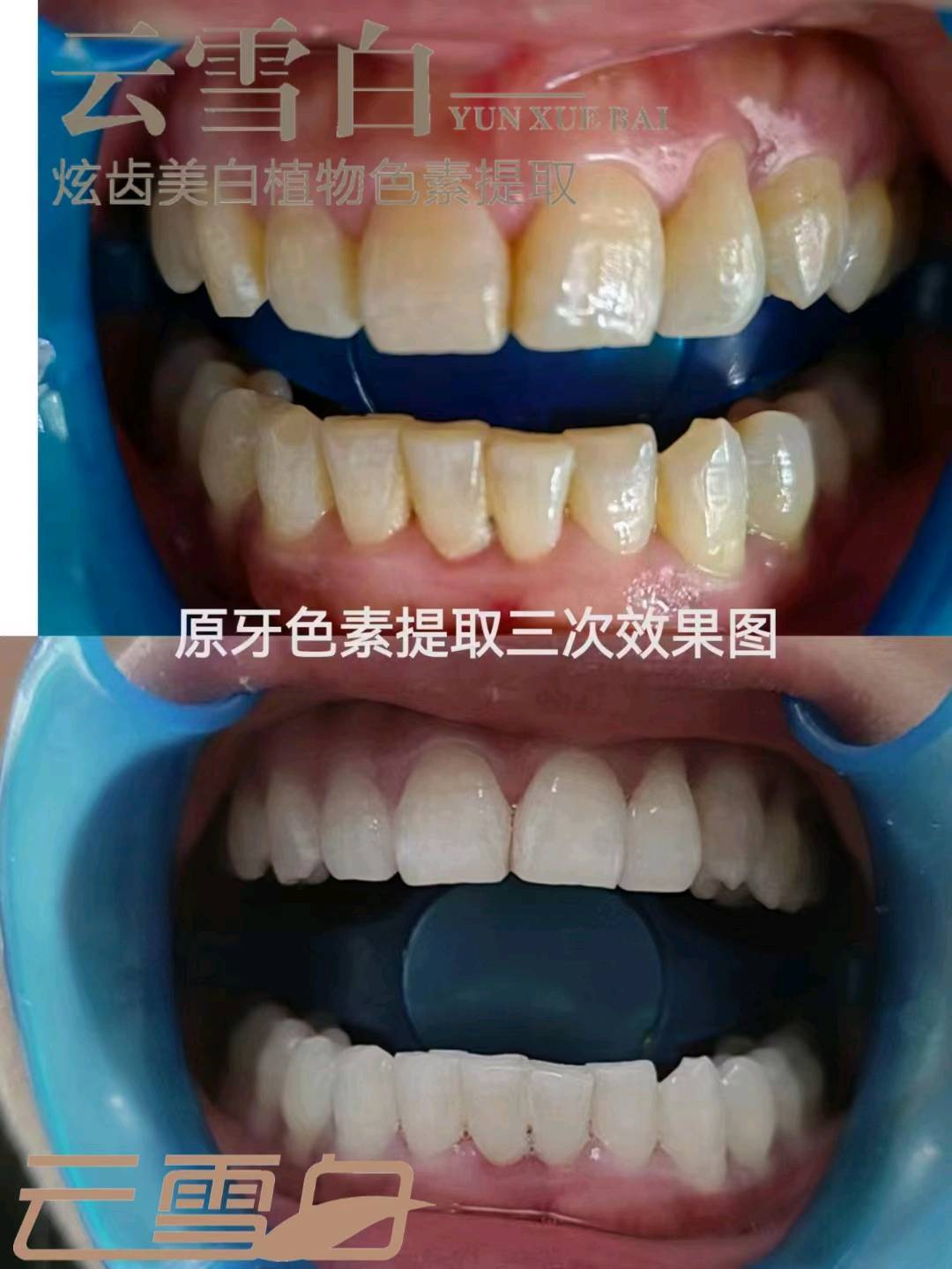 贾先生找合伙人牙齿美白 牙原素色素提取美白自有品牌厂家