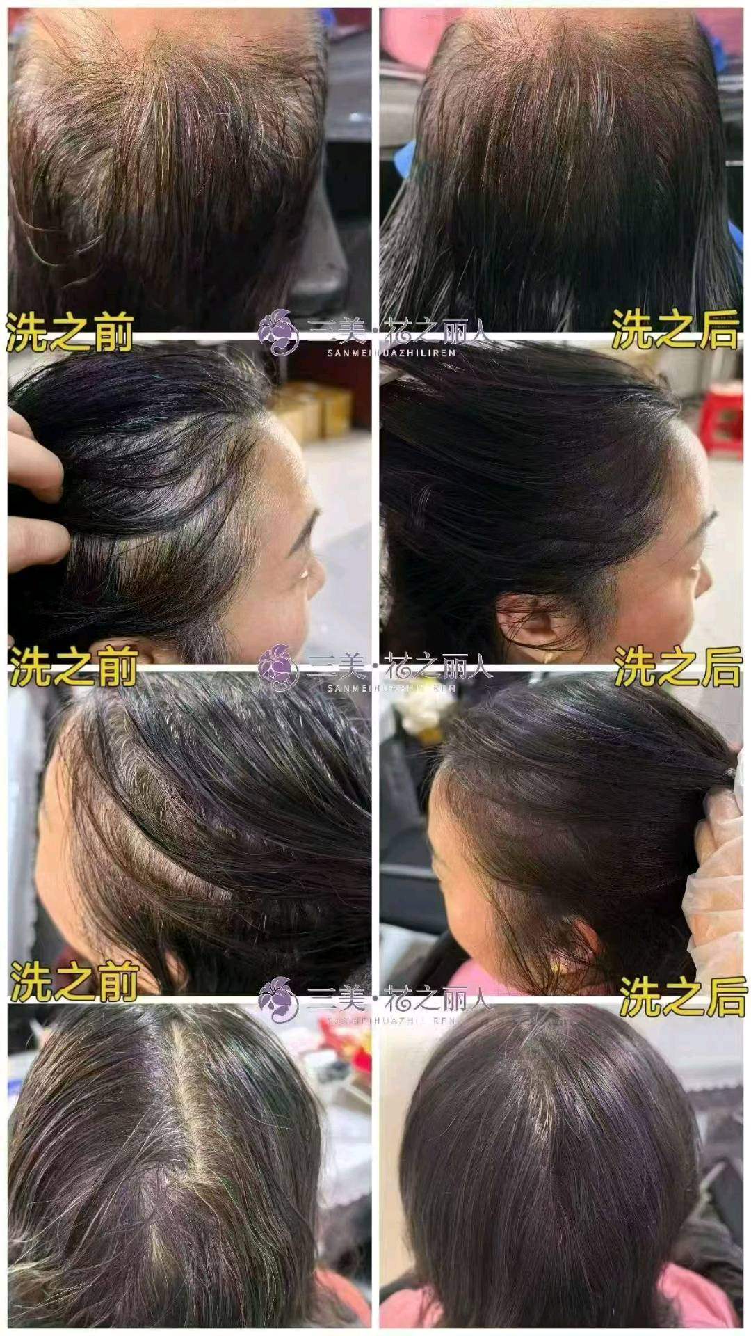 蒙先生品牌货源何首乌白洗黑洗护套装源头供应