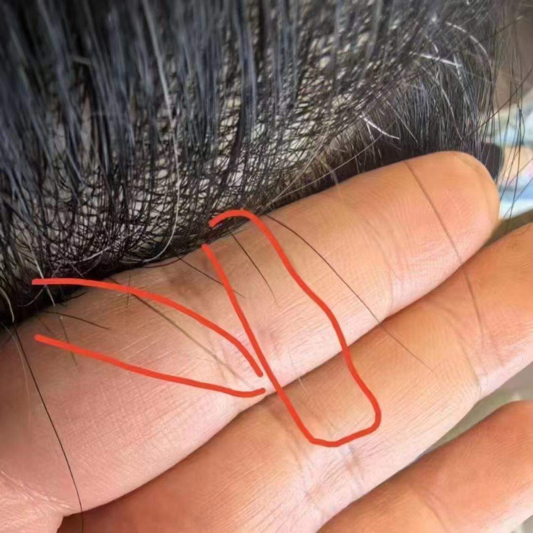 王艳荣其他供需为中医馆白发转黑项目拓客引流