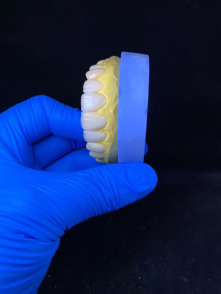 潘俊强全瓷牙片工厂