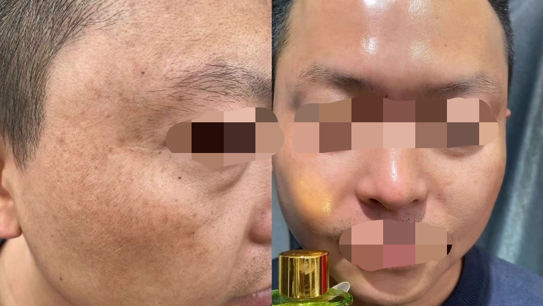 王女士找合伙人试用推广明星调肤护肤品丽之泉