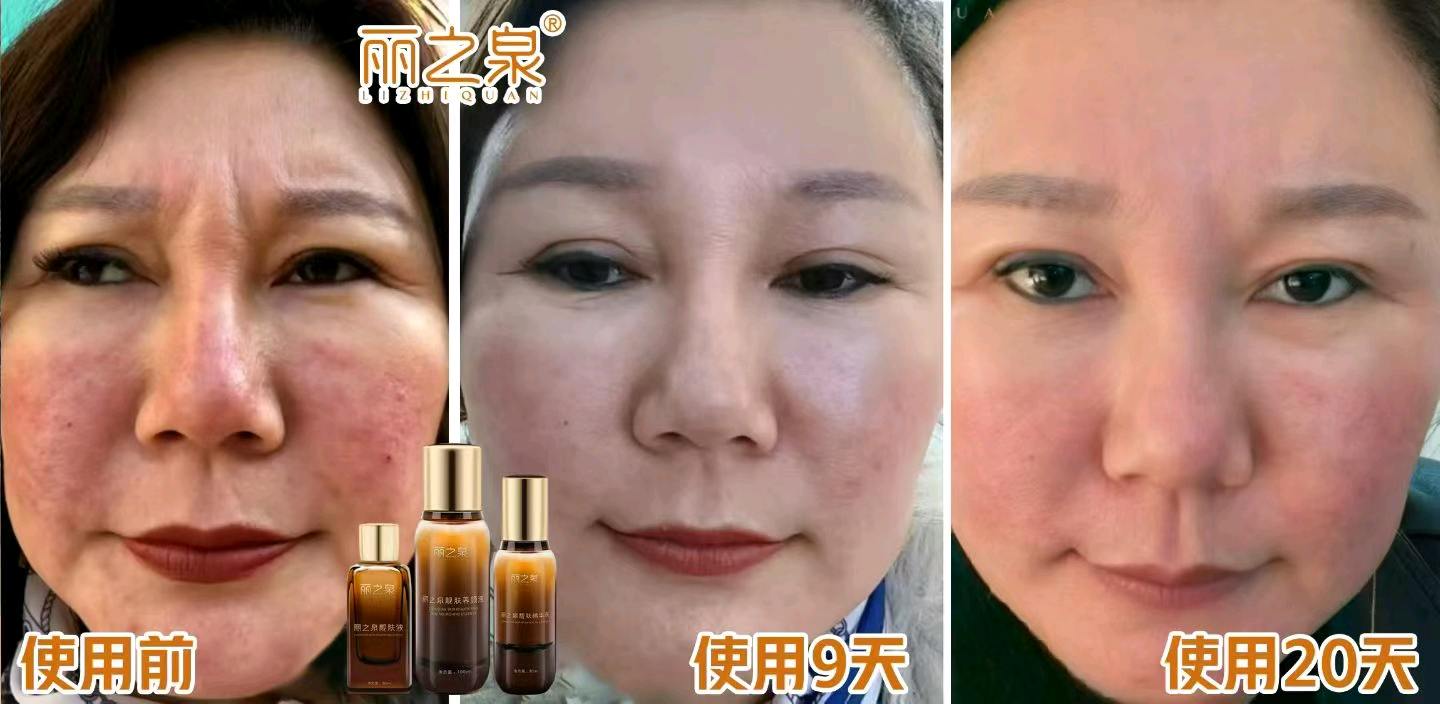 毛先生调肤抗衰赛道，女人爱美的生意调肤抗衰赛道