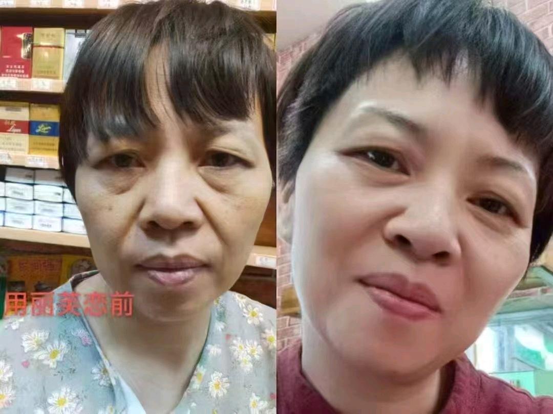 毛先生找合伙人调肤抗衰赛道