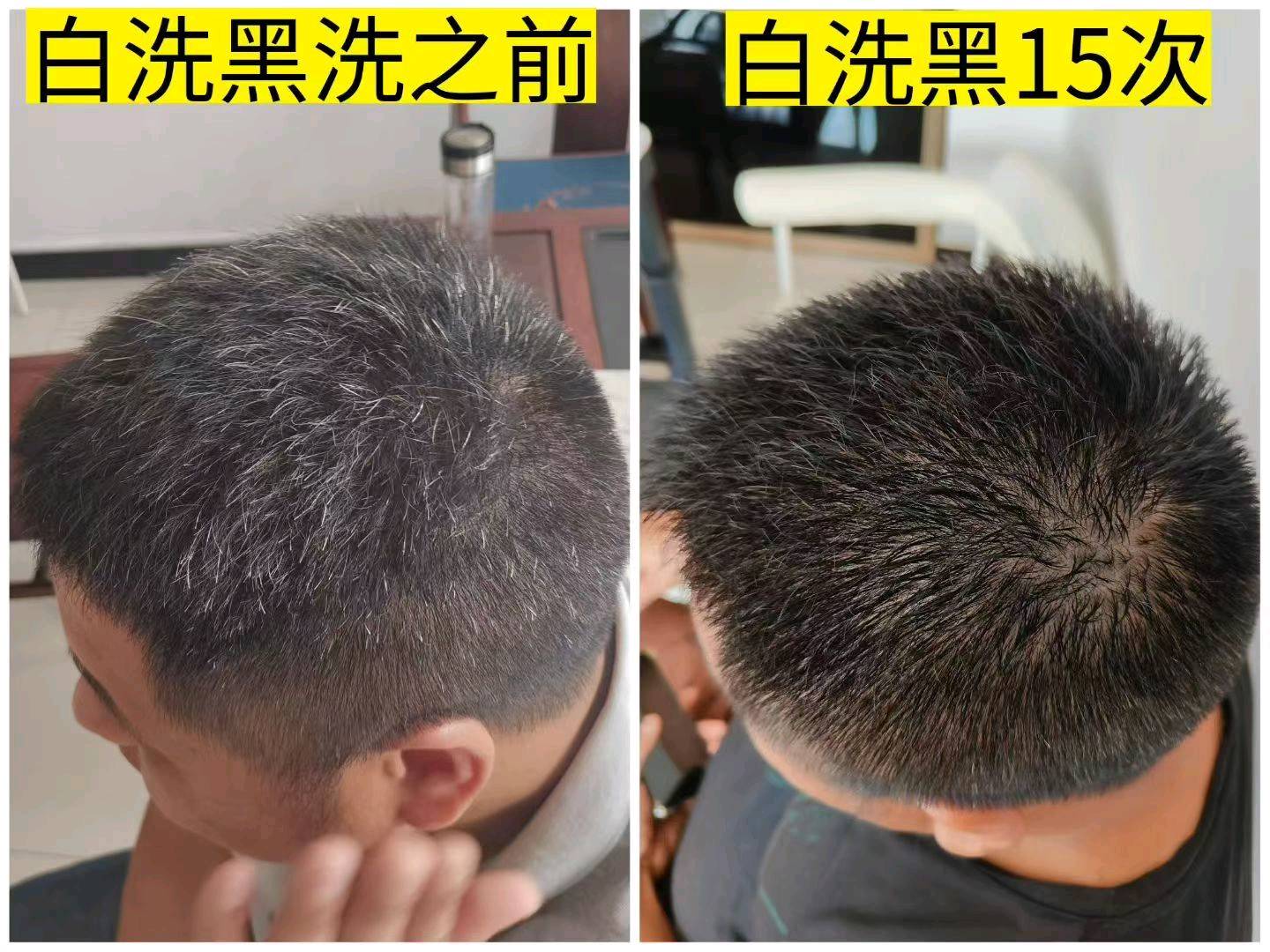 赖先生何首乌白洗黑洗发水套装