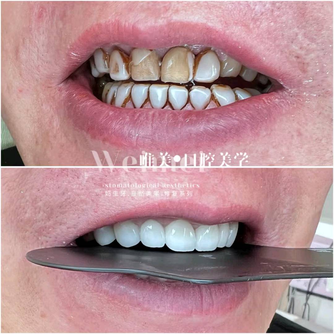 邵女士美牙项目招合伙人+收学员！一手技术，高佣日结，小白也能赚