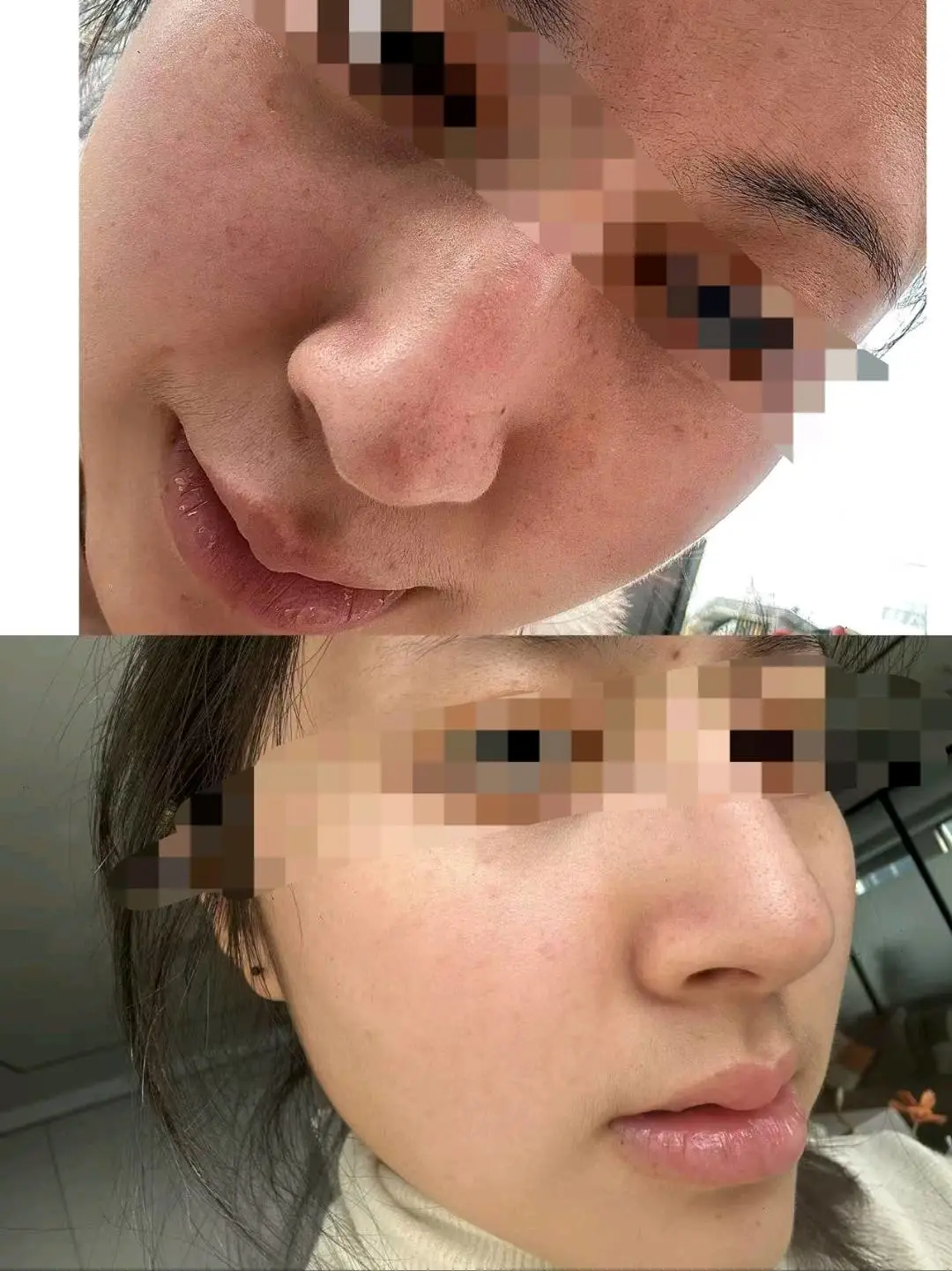 曾苏培找合伙人安科娜,艾丽莎医美产品 寻找市场人81%