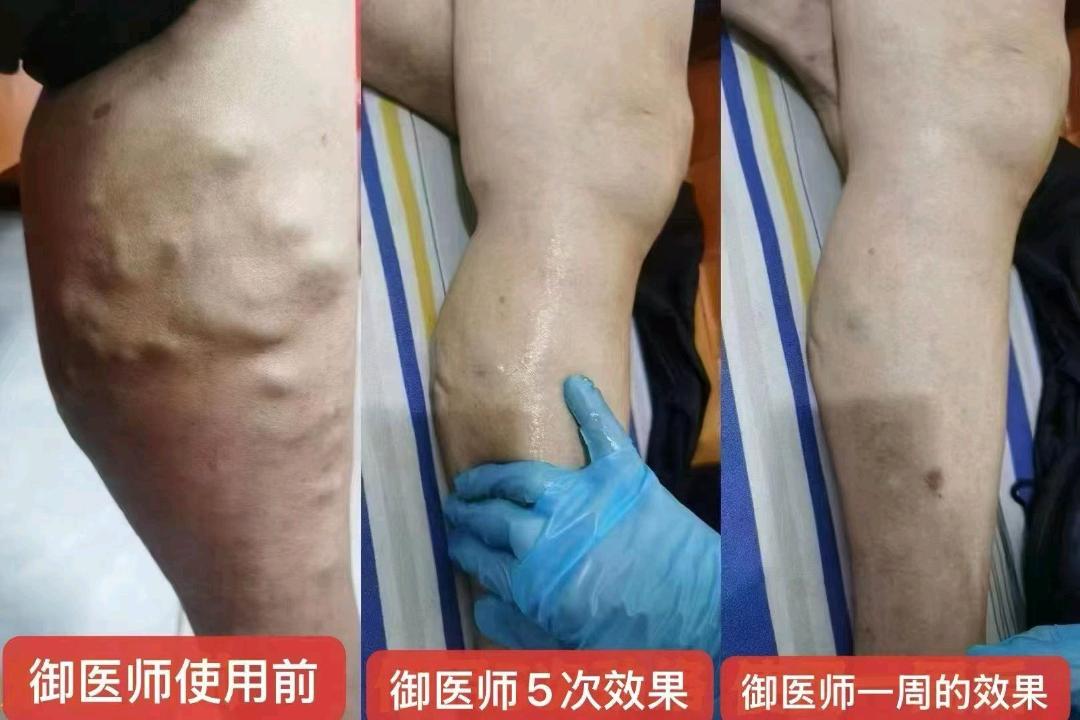 赵志宽品牌货源御医师筋骨通络凝胶招团队长/实体店，高复购，商学院赋能