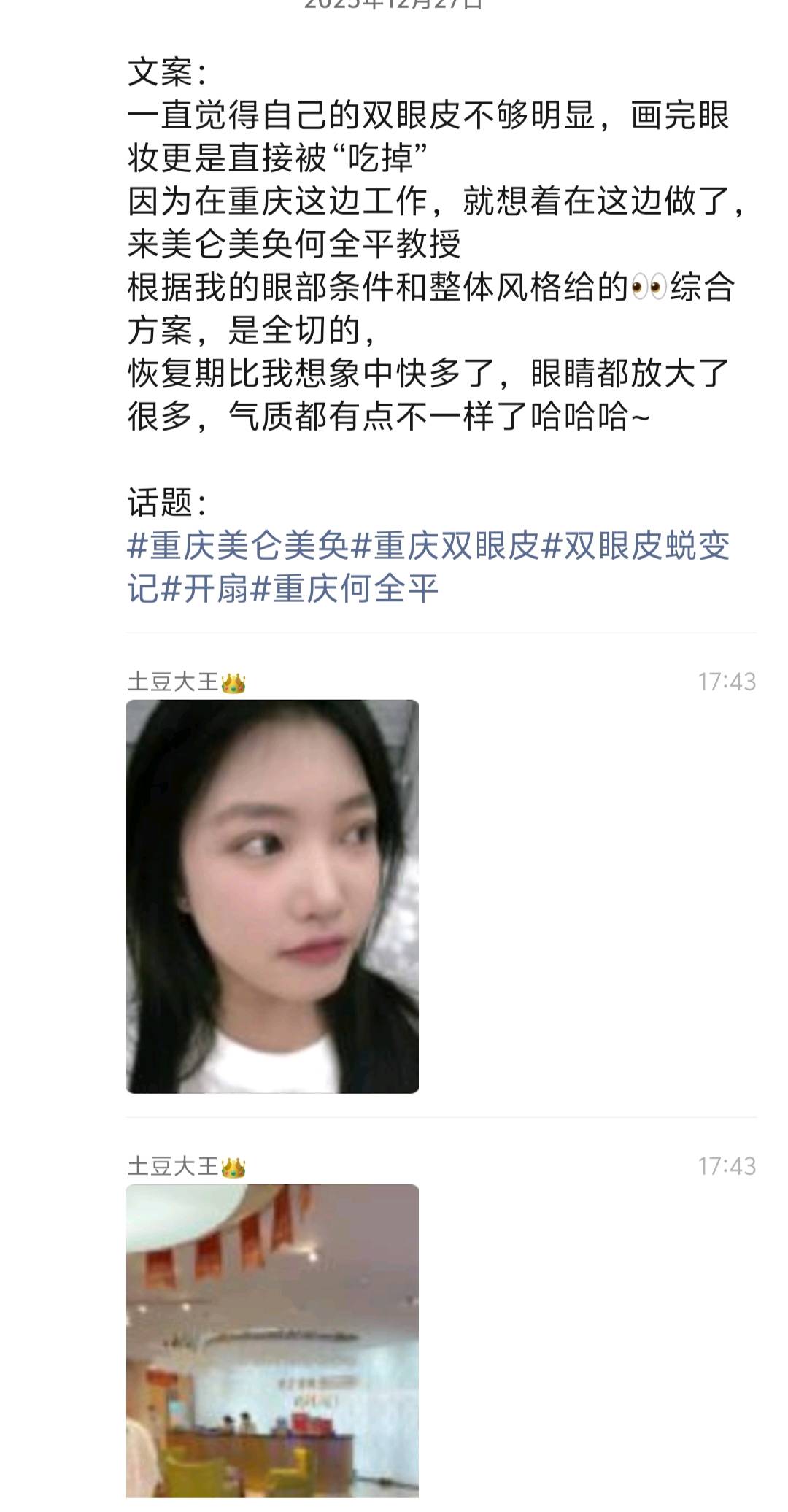 沈国良其他供需纯绿抖音代发，双眼皮医美，一篇25，立结15，一周后结算10，防止删文