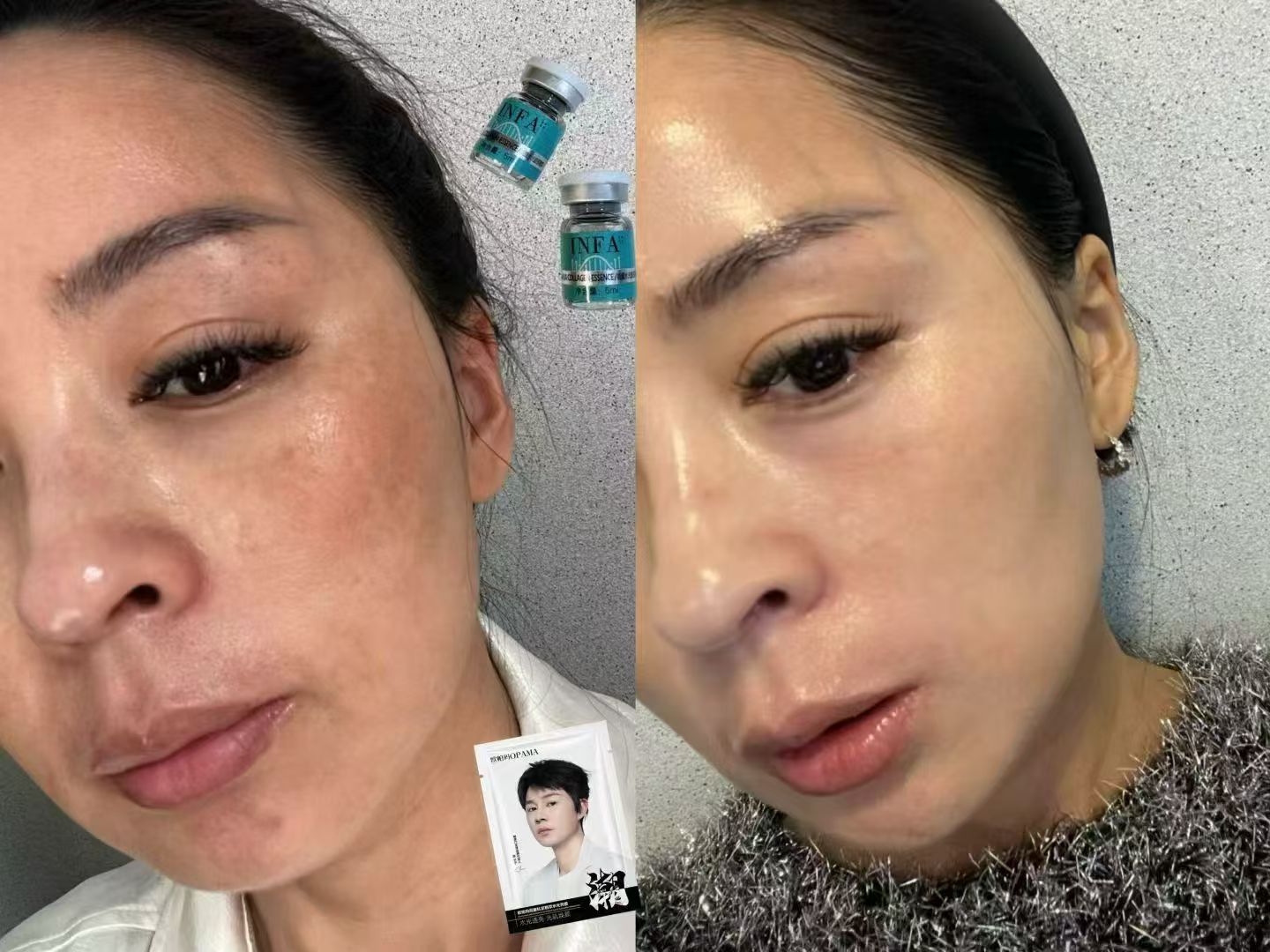 金女士找合伙人居家水光 水光亮膜分享副业,零基础小白轻松入门