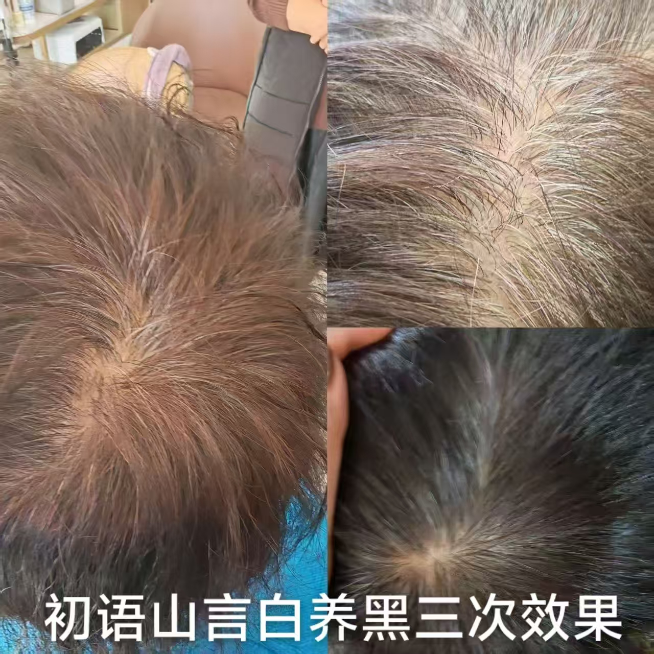 徐先生亿万级市场，招全国合伙人，生态洗发水白养黑！无效全额退款！