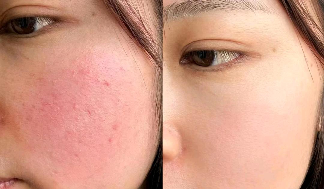 方先生品牌货源械妆双证厂家寻合作,高利润修护产品,一件代发,保护渠道,招代理批发