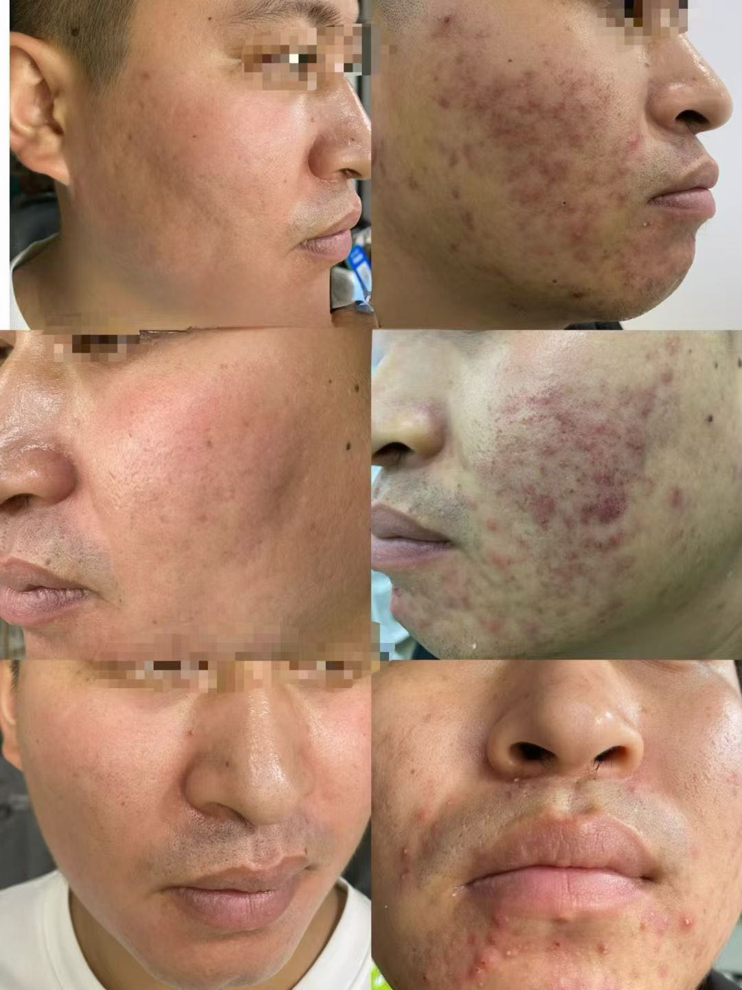 蔡晓研其他供需抖音代发一个5r