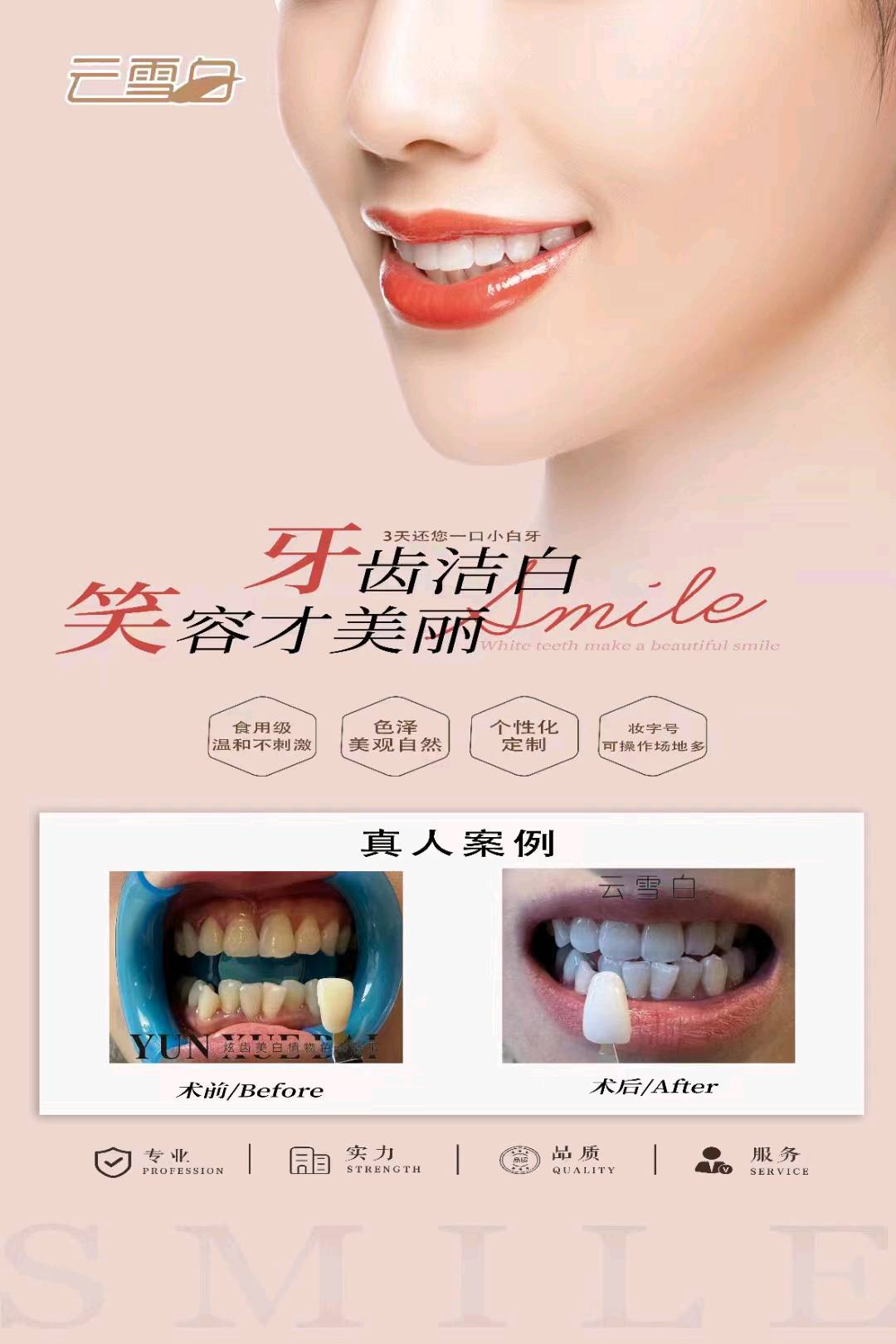 任女士找合伙人牙原素提取美白品牌厂家，牙齿美白