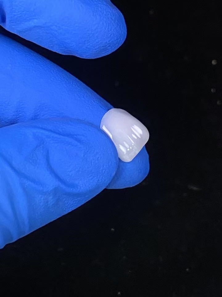 潘俊强品牌货源全瓷片厂家合作全国美牙老师