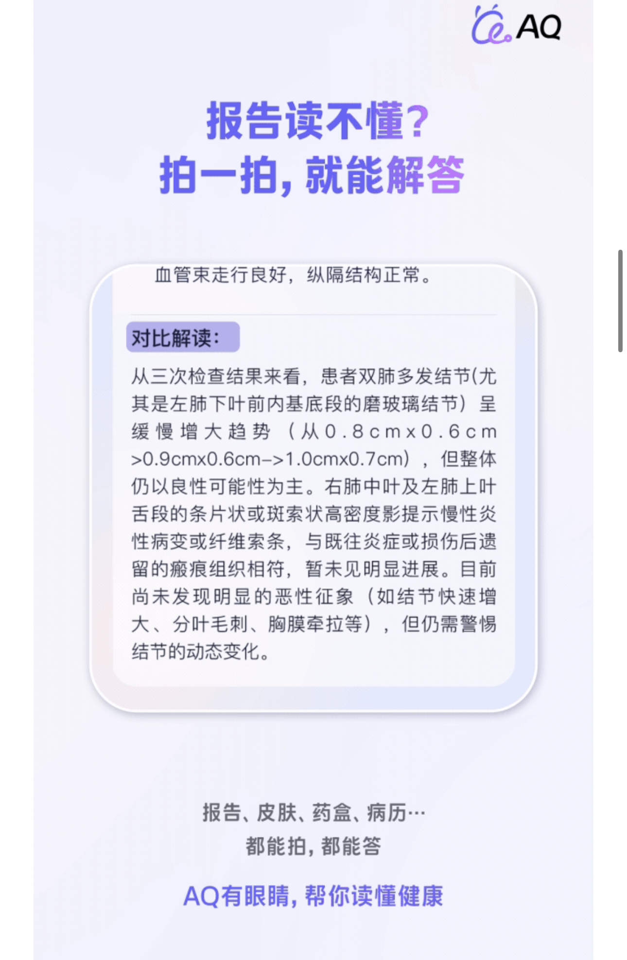 秦先生地推项目