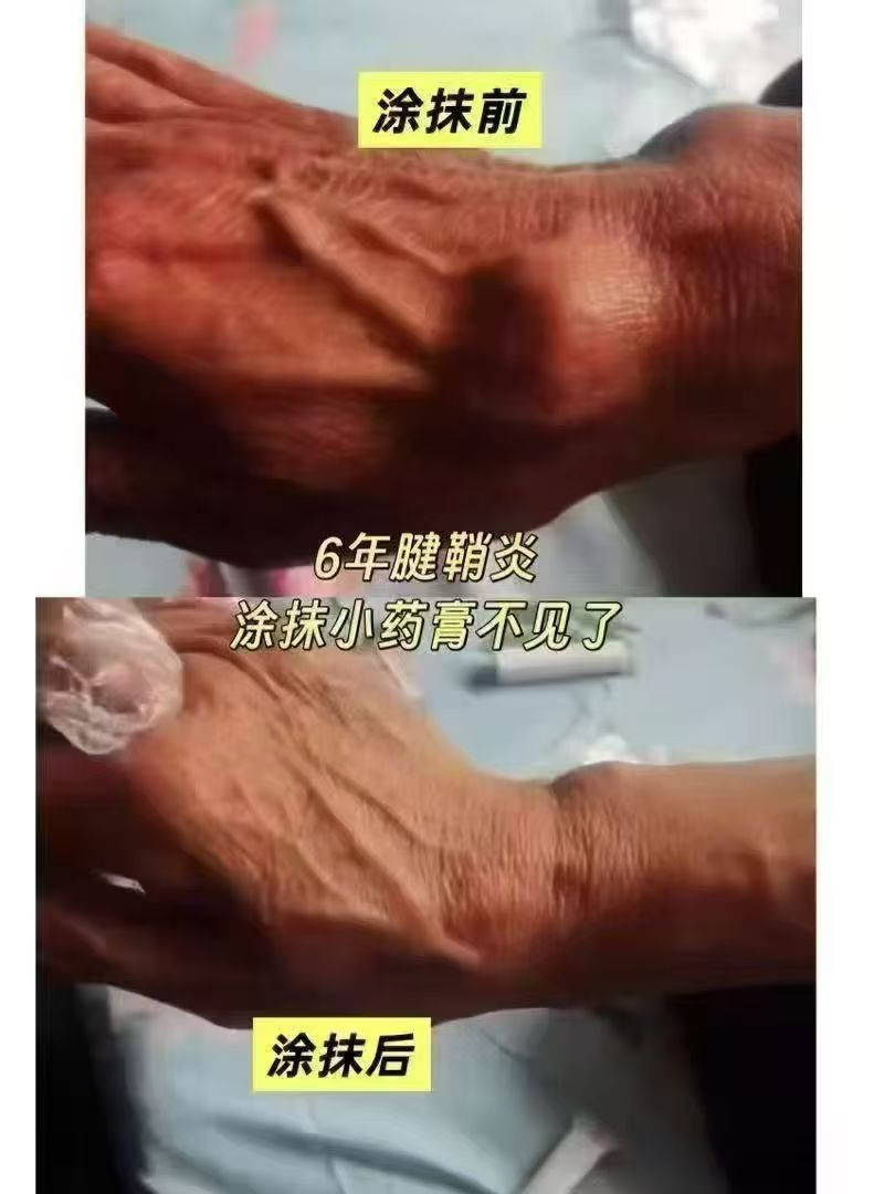 周凯文品牌货源痛症产品无副作用