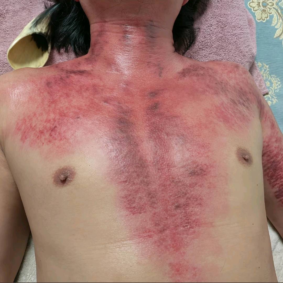 郭先生其他供需义乌本地专业刮痧/艾灸/肩颈调理,上门服务,寻理发店/健身房/养生馆