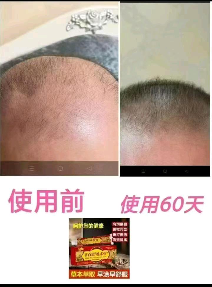 梁梅娇品牌货源痛症产品无激素无副作用