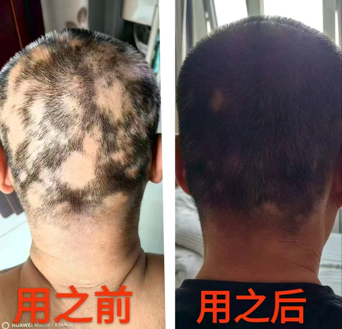 苟平找合伙人初语山言，寻求合作代理