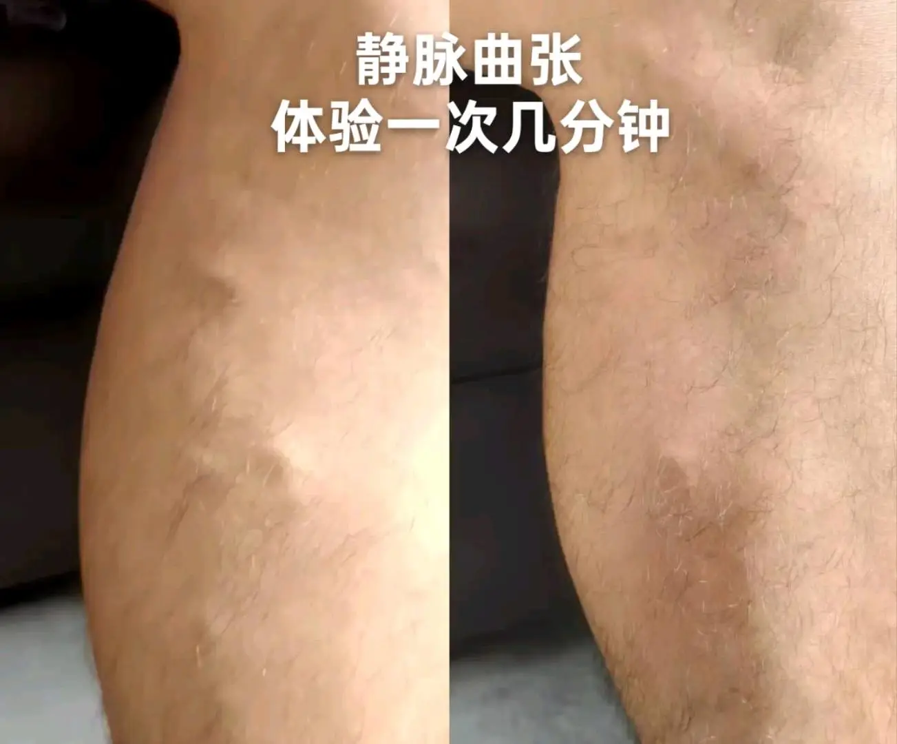 马中元找合伙人朱氏百草疼痛喷剂