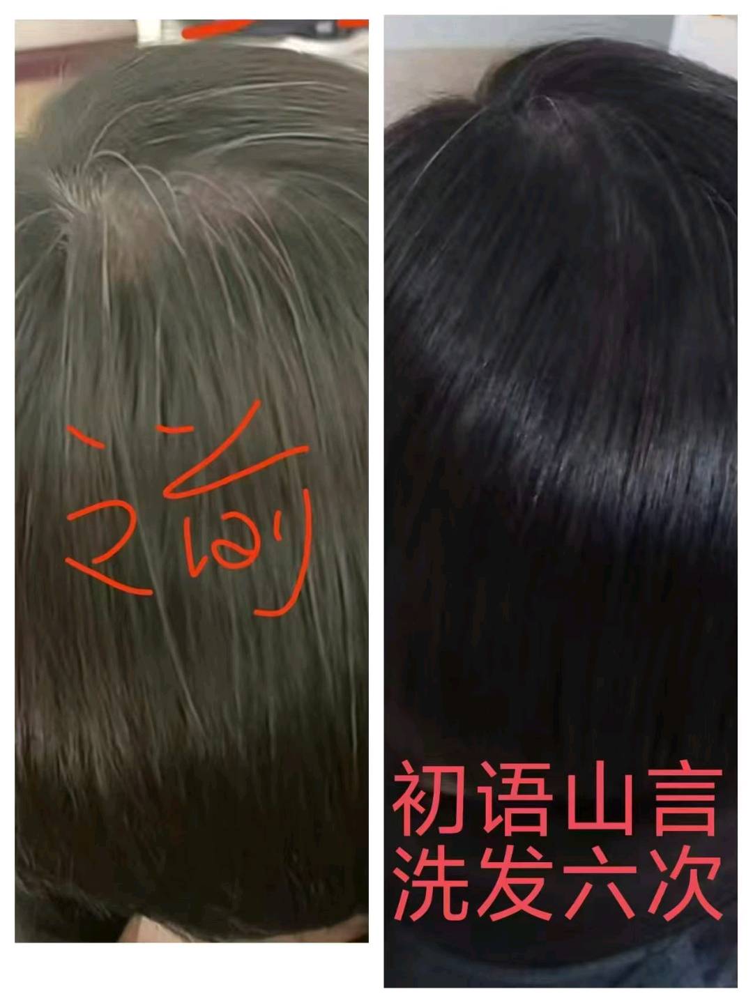 张先生白发养黑 让你实现梦想生活