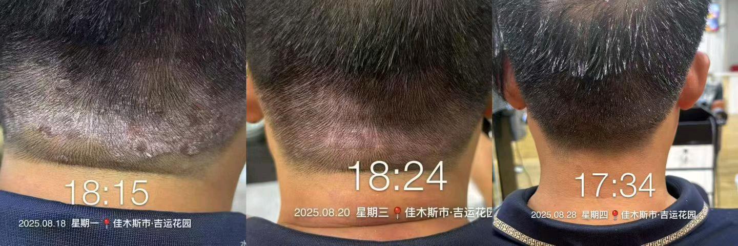 刘盛山品牌货源诚邀全国代理，森发哆国妆特字防脱精华，银发经济，140项检测保障