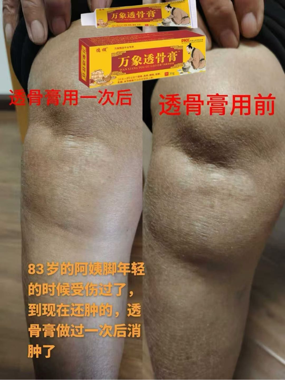 王女士找合伙人万象透骨膏全国招募合伙人，摆摊+自媒体