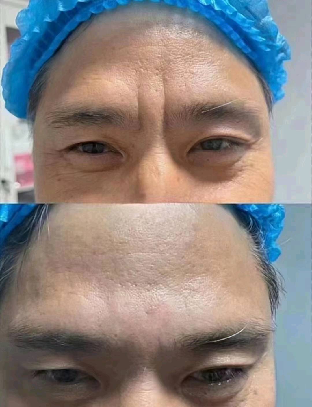 王先生建筑式抗衰美学项目合作：领先技术解决面部衰老问题