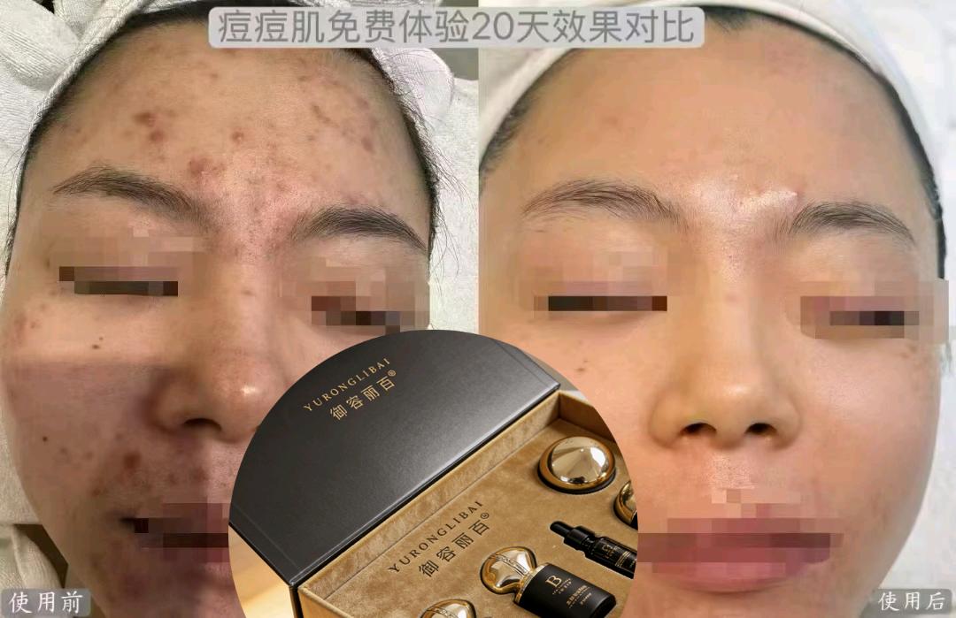 王女士找合伙人御容丽百先用后付美肤项目，招募创业合伙人 500+实体背书