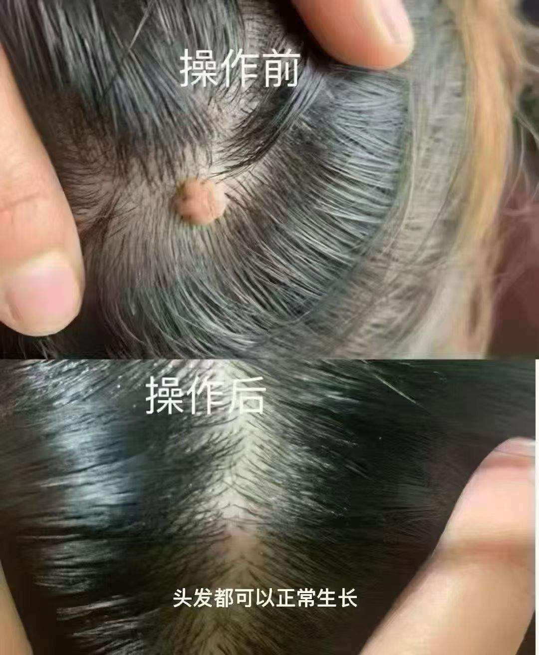 夏晓丰问题性肌肤-斑敏痘痣疣，专做别人做不了的斑，90%的人有需求