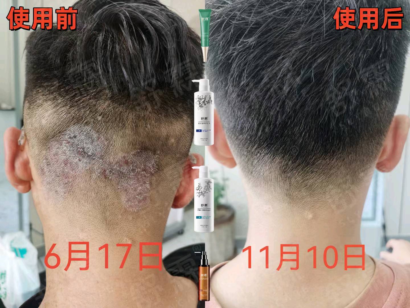胡华琴防脱生发控油去屑，寻找有需要的客户合作