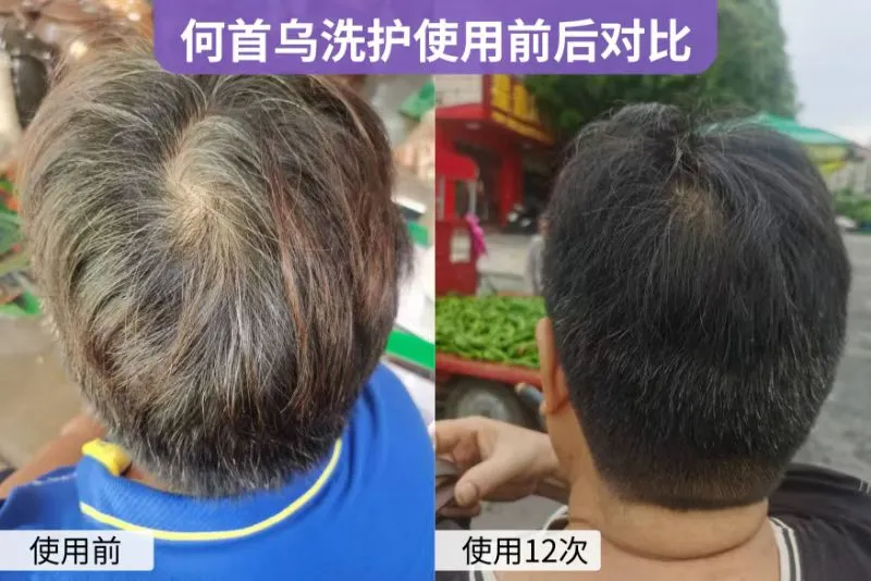 赖先生异业合作广西找门店合作白转黑洗发水套装