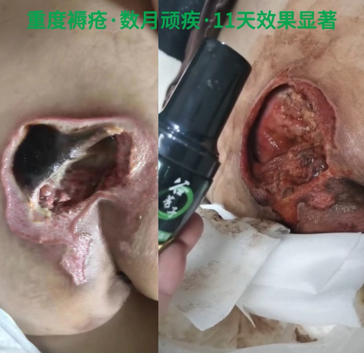 许女士找合伙人全国招募合伙人 全家通用居家创面抗菌养护液 大健康实体刚需项目