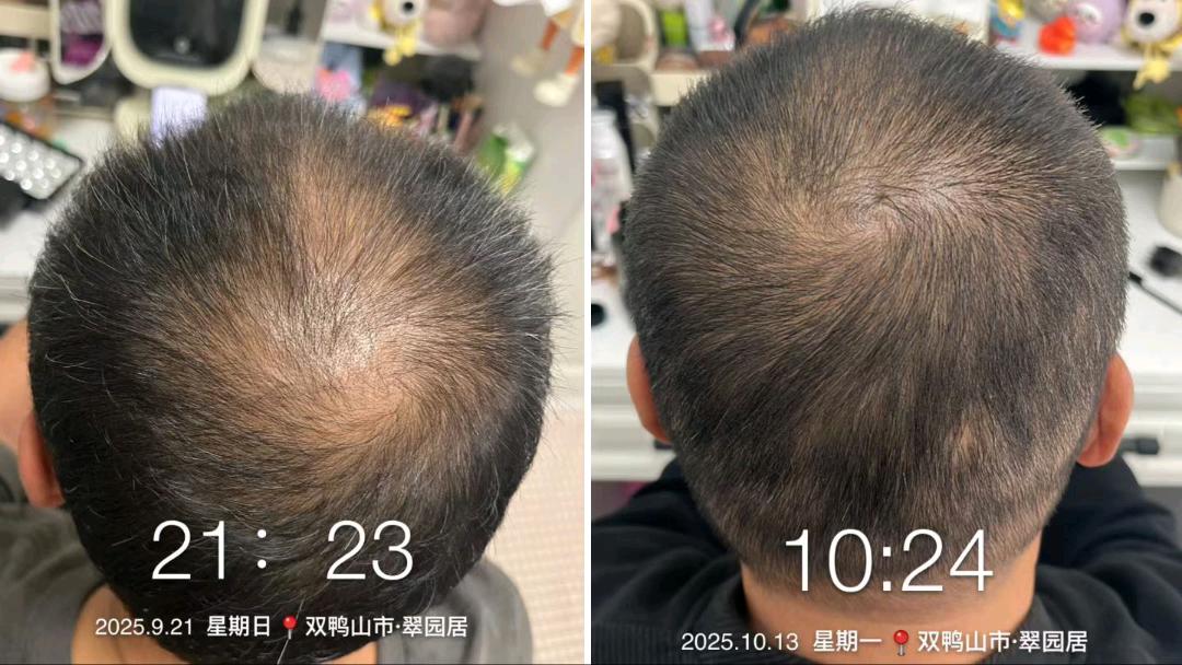 刘盛山找合伙人诚邀全国代理合作，森发哆国妆特字防脱精华，万亿市场，全程陪跑扶持