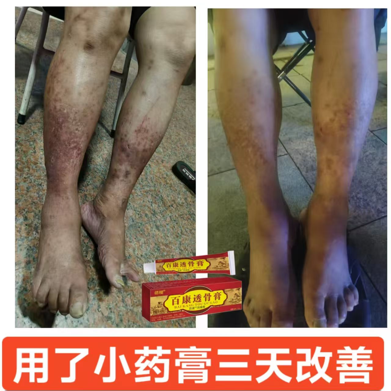 周凯文痛症产品无副作用