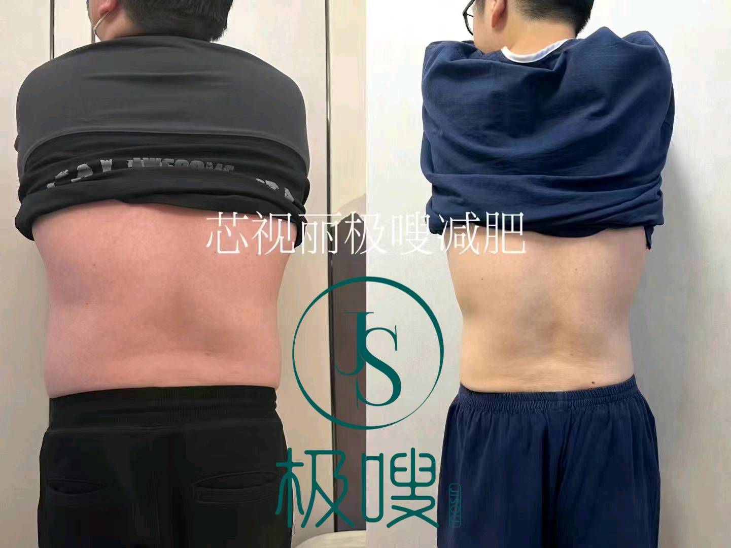 王倩芯片减肥