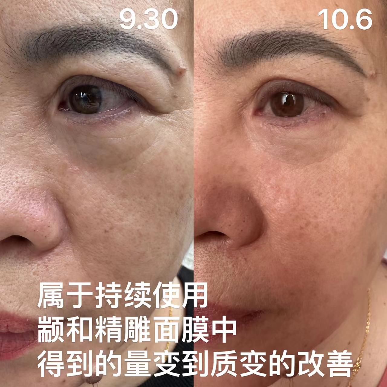 康先生品牌货源抗衰护肤品产品力，1000万现货寻找分销带货只接受分佣