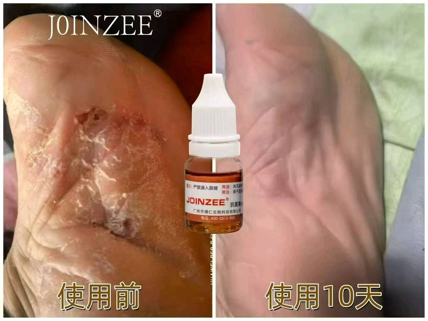 秦悦找合伙人调肤抗衰赛道  脸面生意不分男女  *