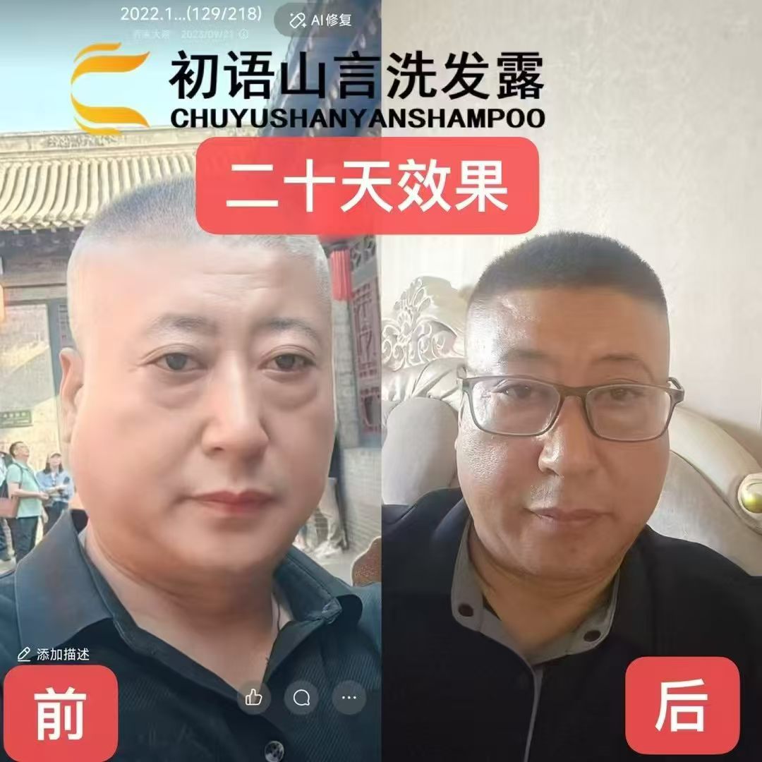 苟平其他供需
