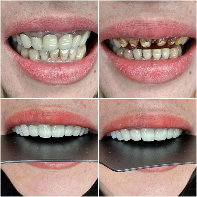 邵女士其他供需美牙项目招合伙人+收学员！一手技术，高佣日结，小白也能赚