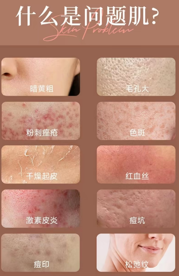 尹堇懿品牌货源植媄提雅找销路