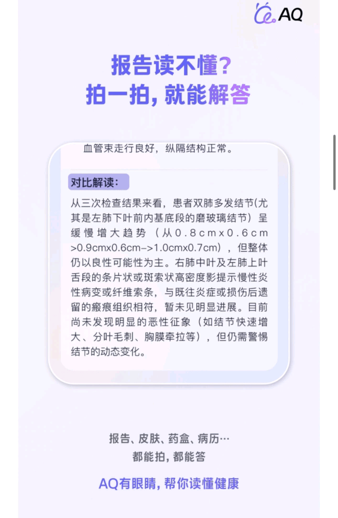 张诚诚地推项目