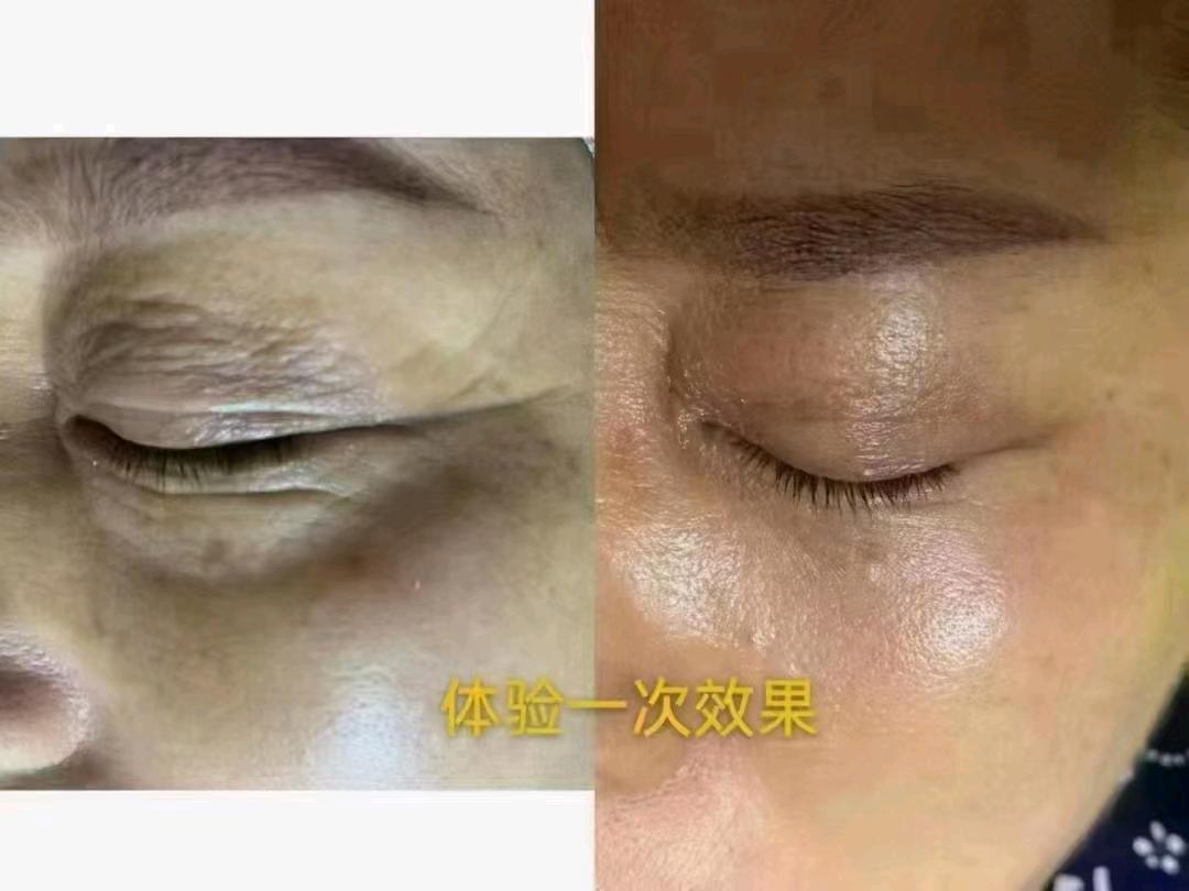 肖代锋找合伙人无创眼部抗衰，599元启动，24小时拓客，月增业绩*