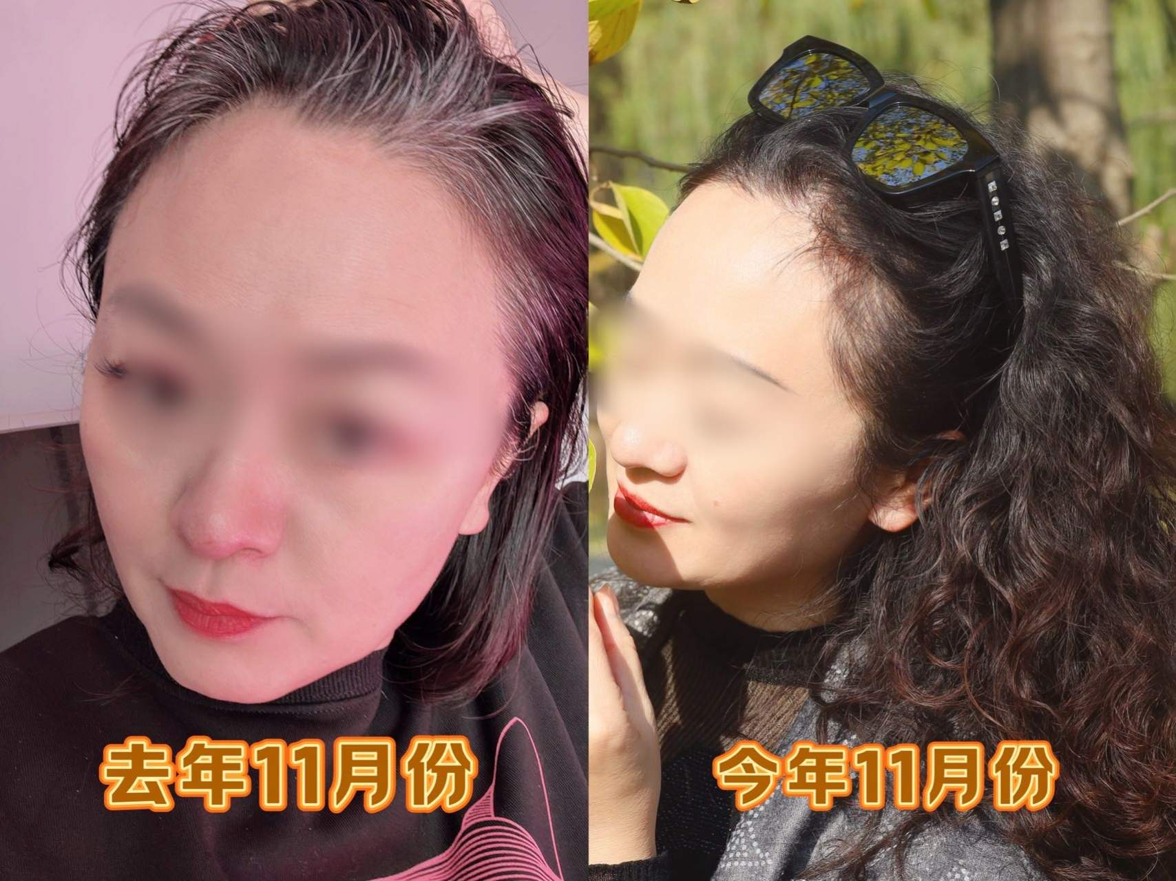 廖女士找合伙人掘金千亿市场！养发行业合伙人招募，共享头皮健康新财富！