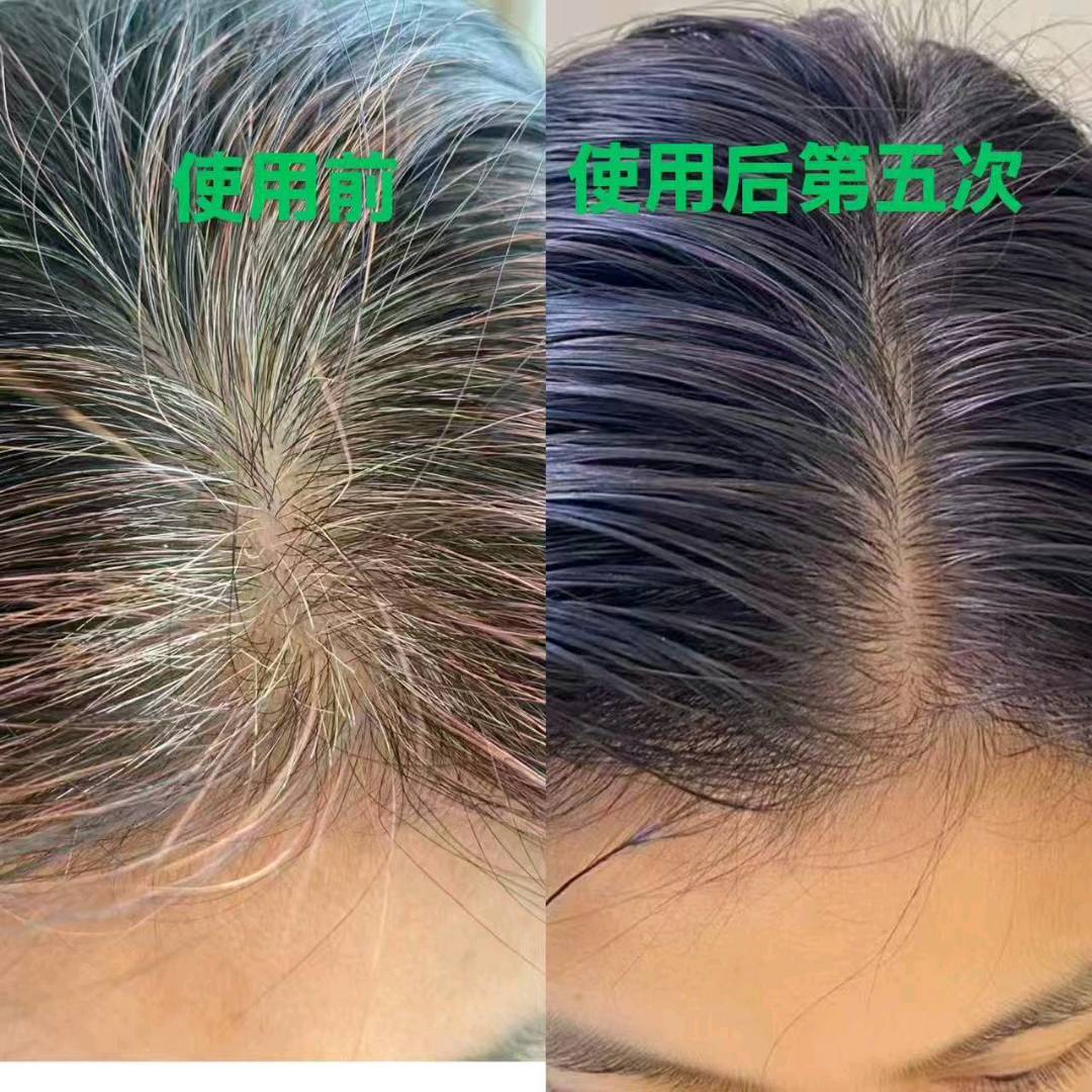 覃女士品牌货源何首乌白洗黑洗护套装源头供应